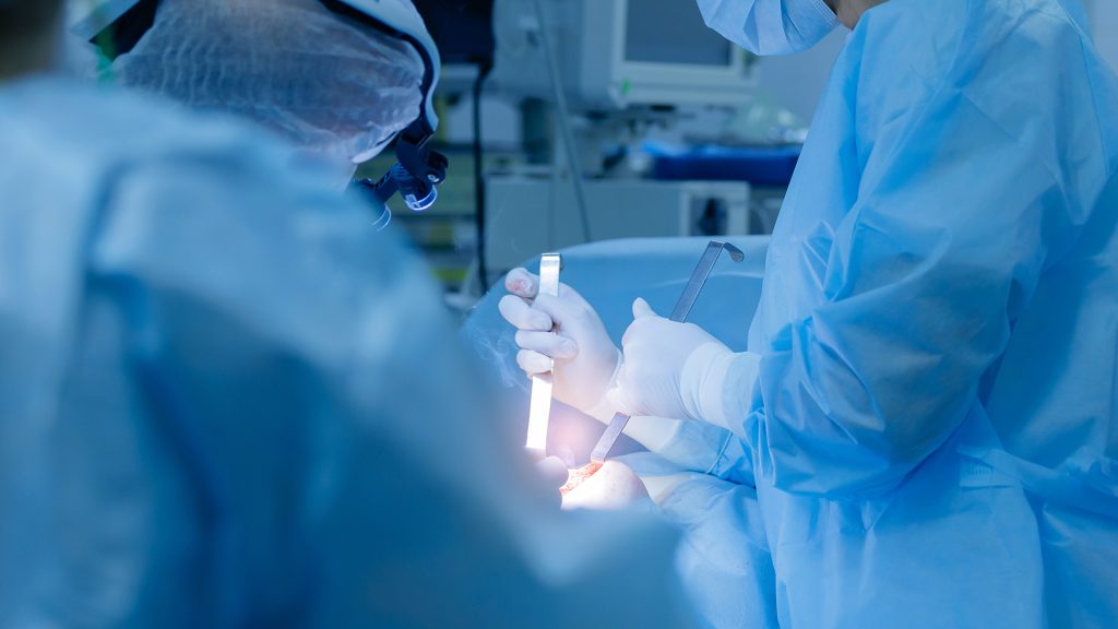 National hernia registry results published for first time