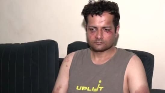 ‘Bleeding through head’: Injured Delhi ACP recalls how crowd overpowered cop during protest