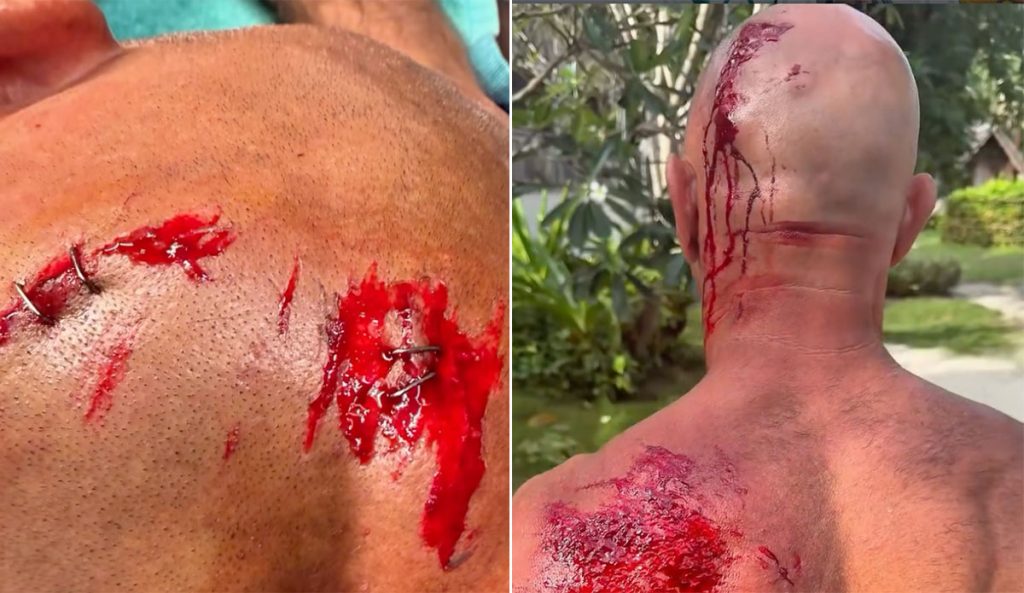 Shane Dorian Got Turned Into Hamburger by an Indonesian Reef