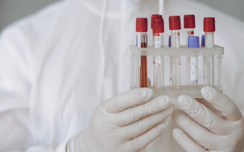 Delhi reports surge in swine flu cases